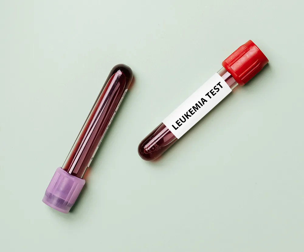 Leukemia Blood Test