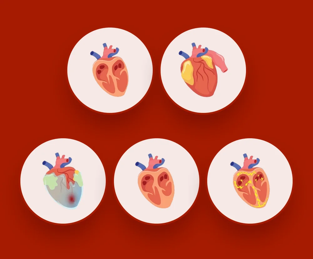 Did you know the 10 main types of heart disease?