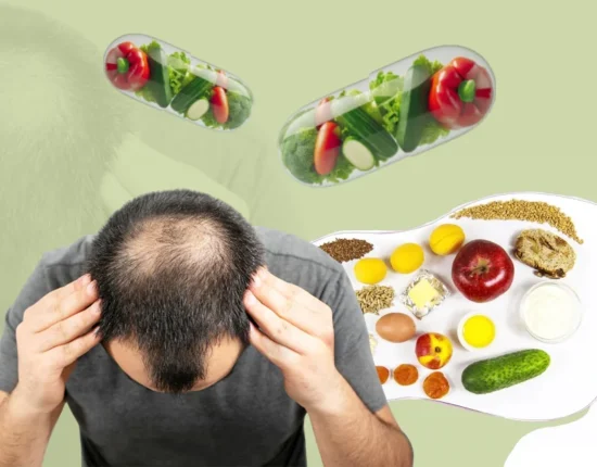 food to prevent hair fall