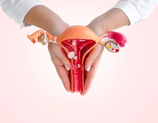 How To Prevent Endometriosis