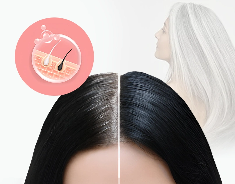 How to Prevent Gray Hair