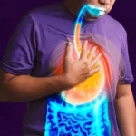 how to prevent acidity
