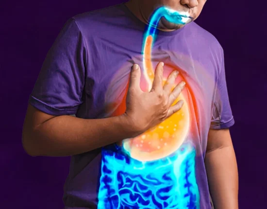 how to prevent acidity