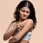 how to prevent fungal infection