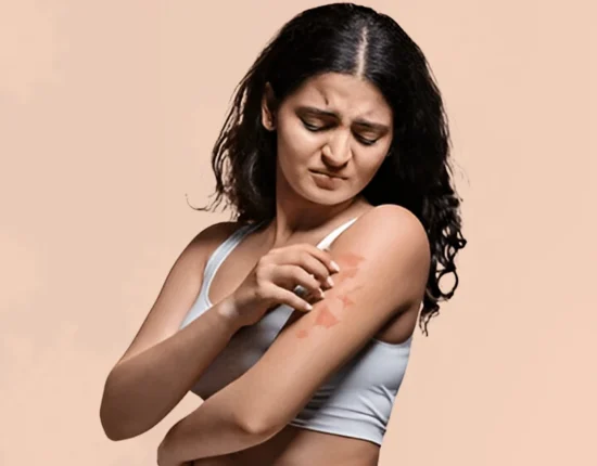 how to prevent fungal infection