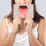 how to prevent mouth ulcers