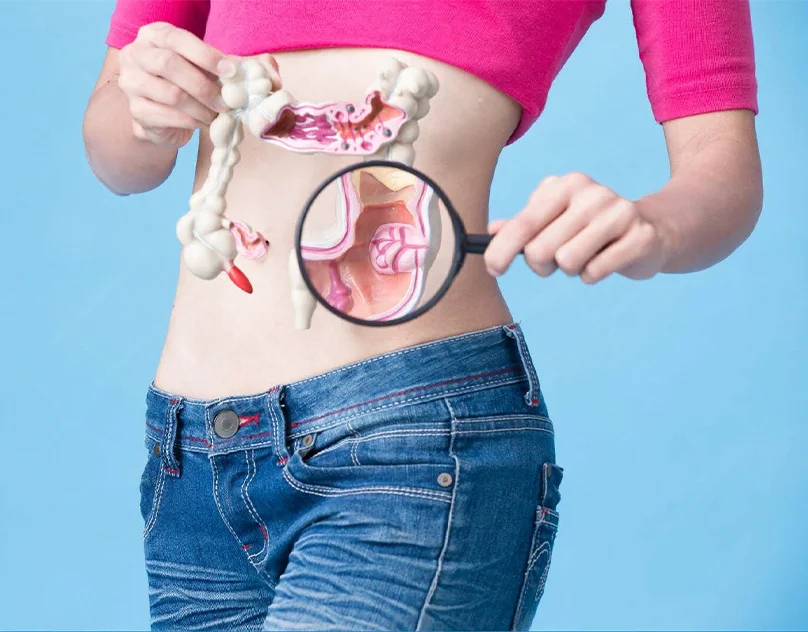 How To Prevent Colorectal Cancer