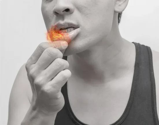 hormonal mouth ulcers