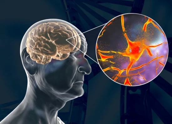 Can You Prevent Alzheimer’s The Role of Genetics in Brain Health