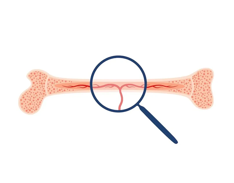 How Bone Marrow Tests Help Diagnose Diseases—and How the Procedure Happens