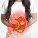 How To Prevent Gastric Problem