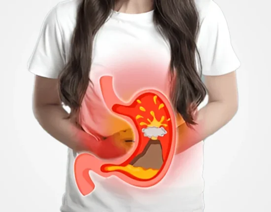 How To Prevent Gastric Problem