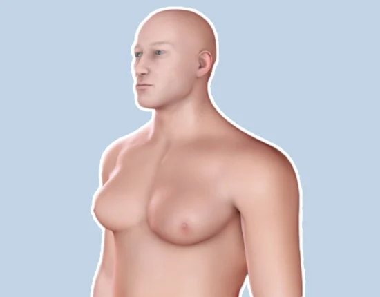 How To Prevent Gynecomastia