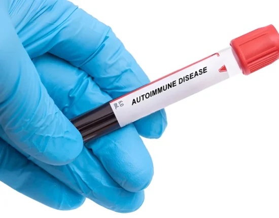 can autoimmune disease be cured