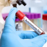 tests for autoimmune diseases