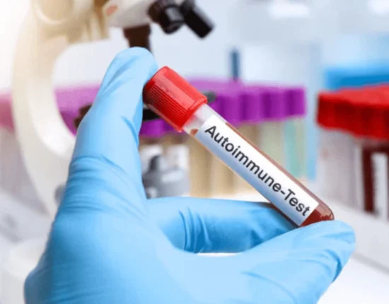 tests for autoimmune diseases
