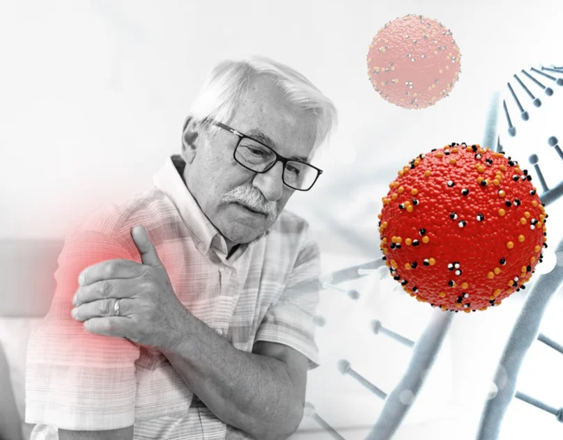 How inflammation accelerates aging mob