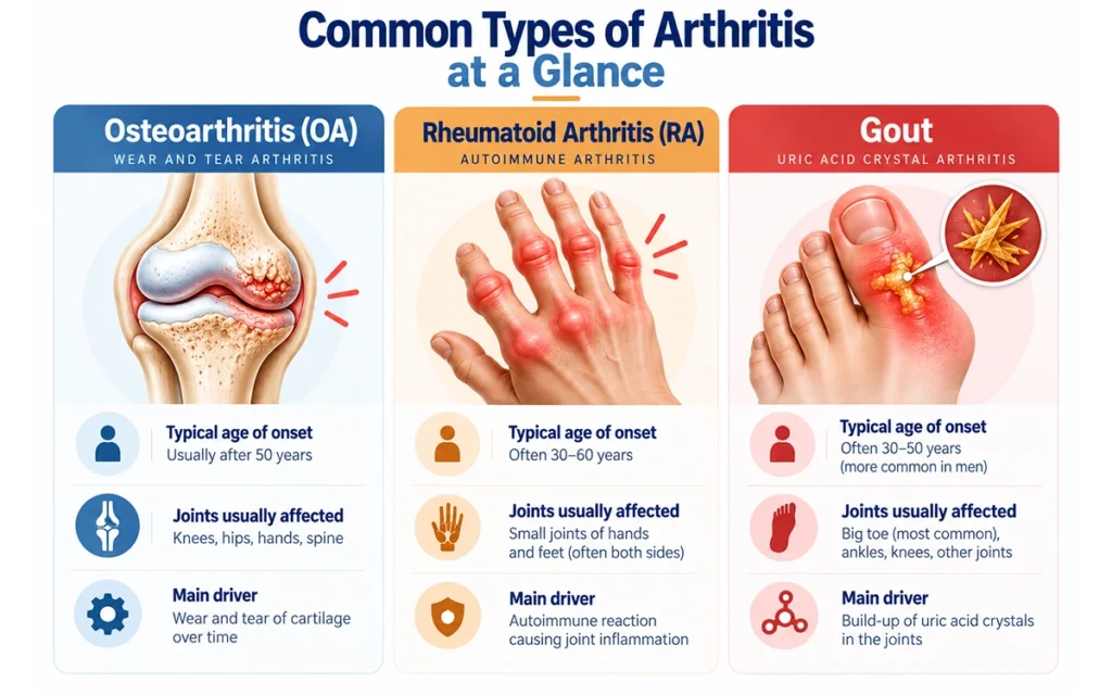 Osteoarthritis arthritis and Rheumatoid arthritis and Gout