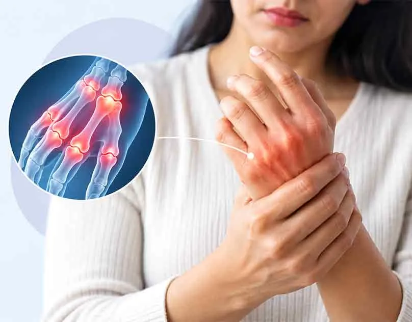 Is rheumatoid arthritis genetic