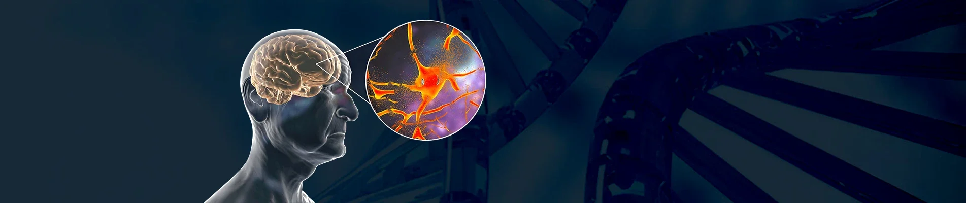 Can You Prevent Alzheimer’s The Role of Genetics in Brain Health