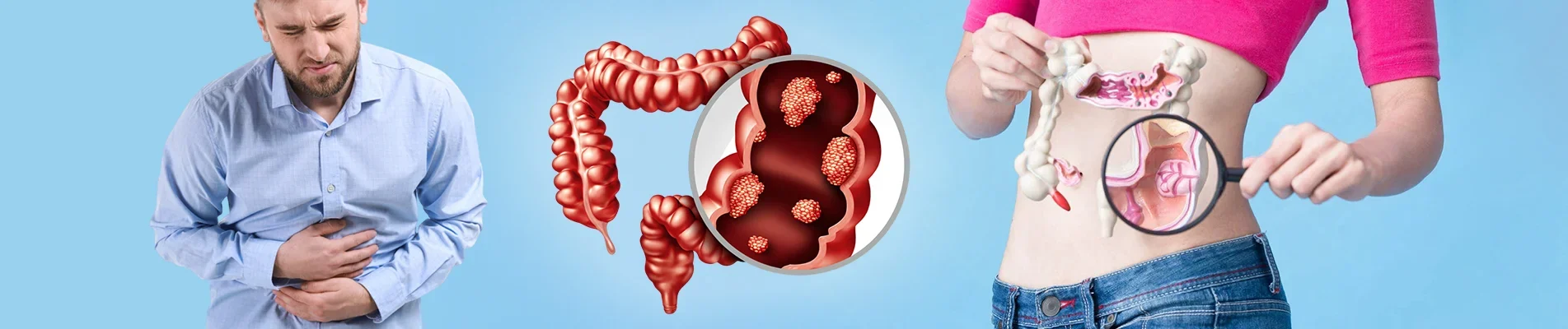 How To Prevent Colorectal Cancer