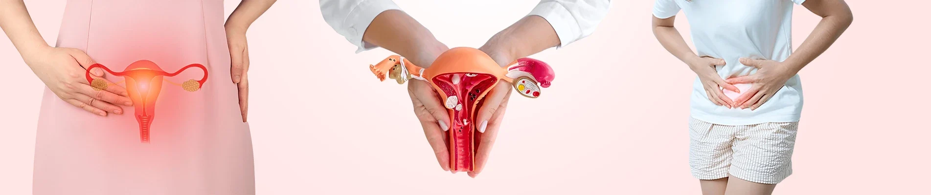 How To Prevent Endometriosis How To Prevent Endometriosis