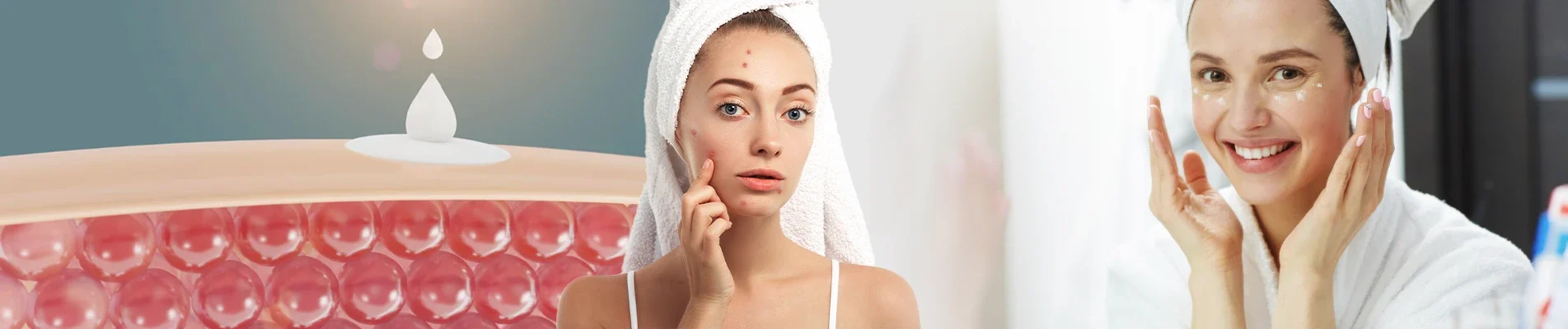 How To Prevent Pimples On Face