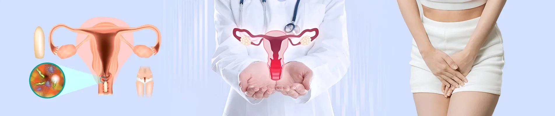 How To Prevent Vaginal Yeast Infections
