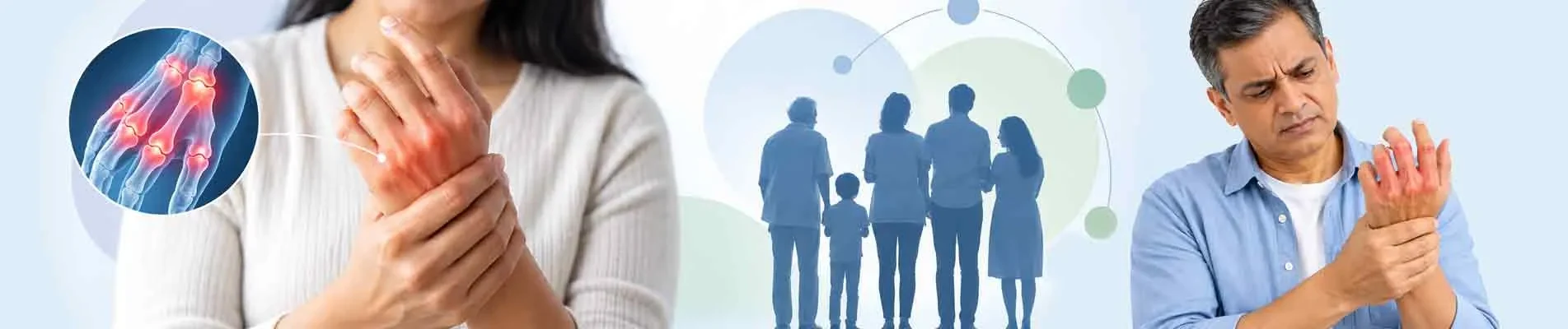 Is rheumatoid arthritis genetic