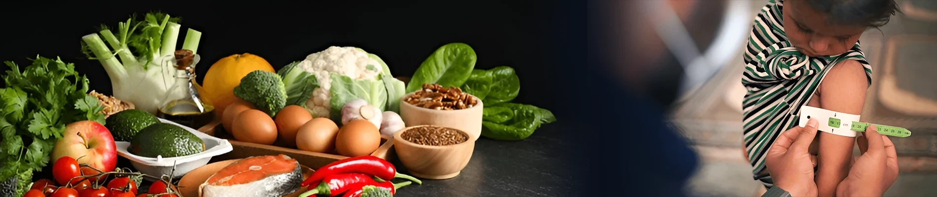 Which Are The Ways To Prevent Malnutrition in a webp image