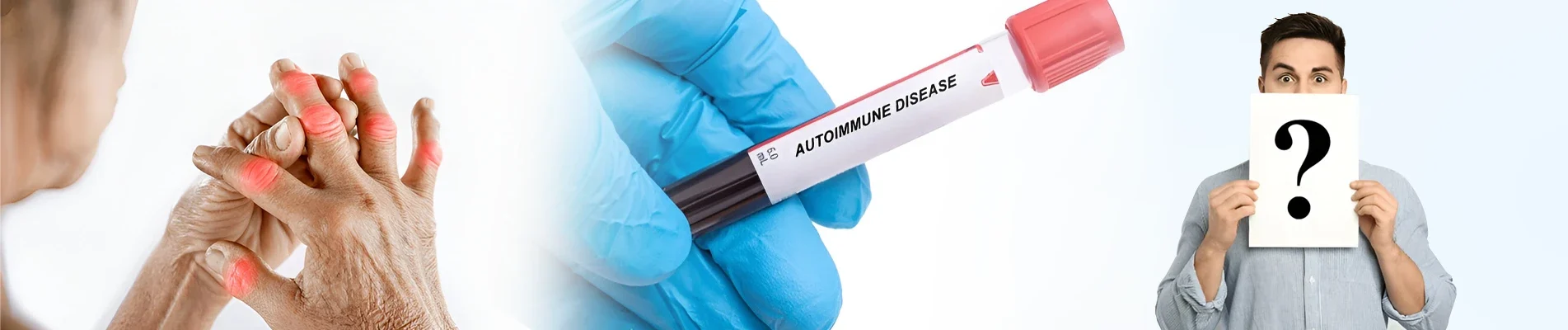 can autoimmune disease be cured