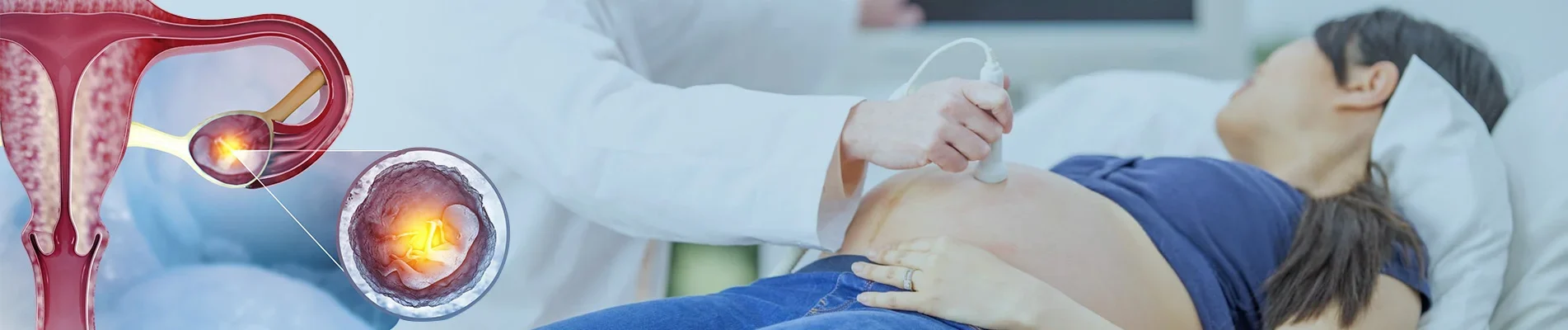 how to prevent ectopic pregnancy