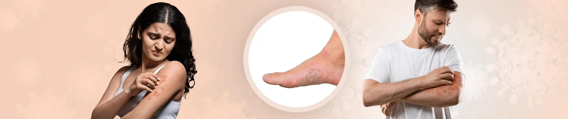 how to prevent fungal infection how to prevent fungal infection