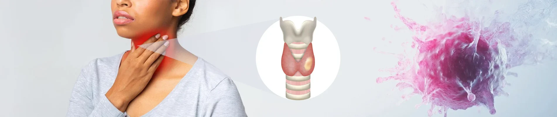 how-to-prevent-throat-cancer
