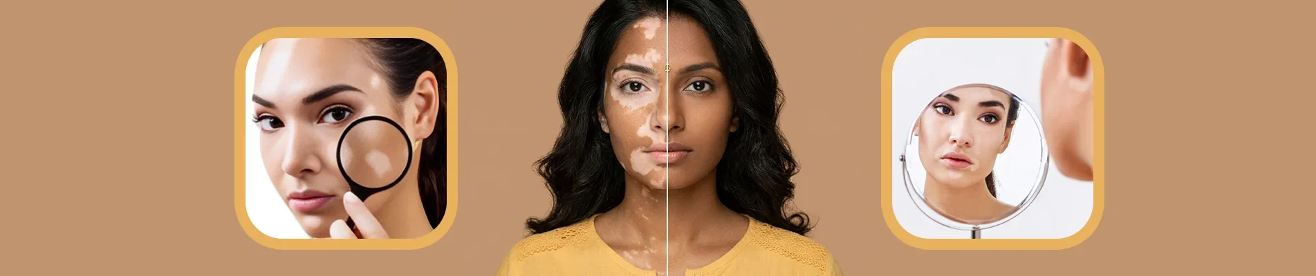 how to prevent white spots on face