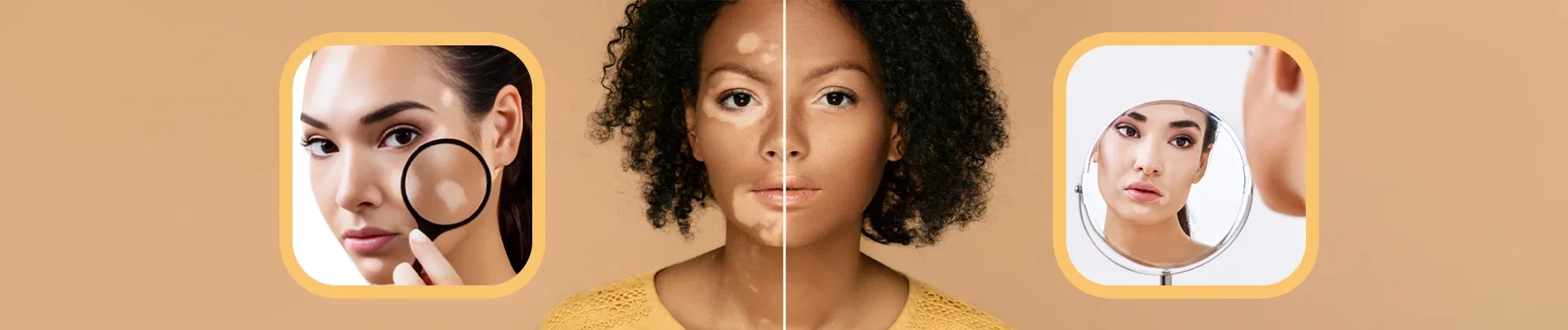 how to prevent white spots on face