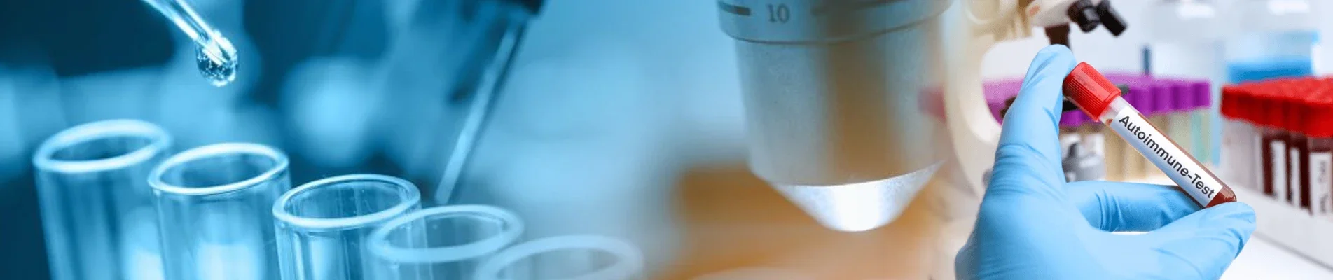tests for autoimmune diseases